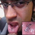 El indio que tiene tatuada una esvástica en el labio