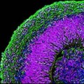 Crean "minicerebros" de células madre