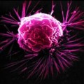 Crean un método para reclutar células que aniquilen el cáncer