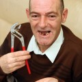 Un hombre se saca 13 dientes con un alicate porque no encuentra dentista en la seguridad social