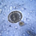 EEUU: Fotos de óvulos fertilizados podrían ser considerados pornografía infantil en Dakota del Norte [ENG]