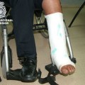Detienen a un hombre en Barcelona con una pierna 'escayolada' con cocaína
