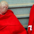 Interior admite a trámite la petición de asilo del inmigrante negro albino