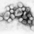 Primera imagen del virus H1N1