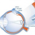 Primeros implantes retinales probados en humanos comienzan a devolver 'algo' de visión (ING)