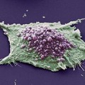 Por primera vez se ve funcionar a una proteína que mata células cancerígenas
