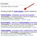Google: Bing copia los resultados de nuestras búsquedas [ING]