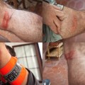 Así me han dejado los Mossos d'Esquadra después de la paliza, a pesar del brazalete de prensa