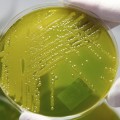 Así mata E. Coli O104:H4, la bacteria de la "crisis de los pepinos"