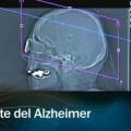 Científicos españoles desarrollan una vacuna preventiva contra el alzheimer testada en ratones