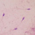 La eyaculación frecuente mejora la calidad del ADN en los espermatozoides