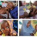 Bebé somalí se recupera tras estar al borde de la muerte por la hambruna