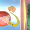 El ojo biónico láser  que permite ver a los ciegos con una calidad de 576 píxeles en escala de grises EN