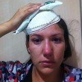 Chica herida por disparo de pelota de goma en la manifestación del pasado martes en Madrid
