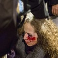 Una mujer pierde la vista de un ojo tras las cargas policiales