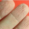 Descubren utilidad de dedos arrugados en condiciones húmedas