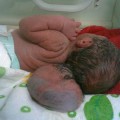 Los defectos de nacimiento en Irak son más graves que en Hirosima [ENG]