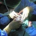 Médicos alicantinos consiguen erradicar los síntomas del párkinson
