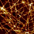 Identificado el detonante molecular de la enfermedad de Alzheimer