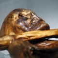 Ötzi y el trauma craneoencefálico