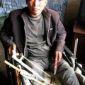 Un hombre chino se amputa una pierna en casa porque no tenía dinero para pagar la operación