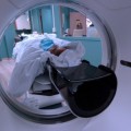 ¿Es peligrosa la Tomografía Computarizada?