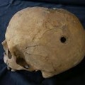 Trepanación. O la Cirugía del Cráneo en la Prehistoria