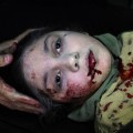 “Foto del año 2013″ por la Unicef: la mirada de una niña siria herida