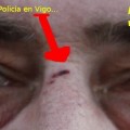 Agresión Policial en Vigo: Por pedir explicaciones sobre el enganche con la grúa de mi vehículo