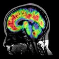 Logran reconstruir el rostro de una persona “leyendo” el cerebro mediante resonancia magnética