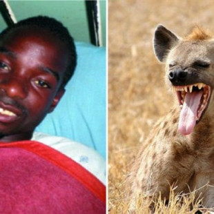 Dejó que una hiena se comiera sus genitales para ser rico