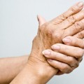 El nuevo tratamiento que combate de raíz la artrosis y la detiene por completo