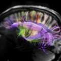 Centenares de neurocientíficos se rebelan contra el megaproyecto europeo para simular el cerebro