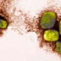 Encuentran viales del virus de la viruela en un laboratorio no acondicionado de Maryland. [ING]