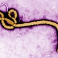 Uno de los estadounidenses infectados con Ébola se está recuperando gracias a un nuevo tratamiento experimental