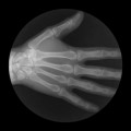 Asombrosos GIFs de rayos X muestran articulaciones en movimiento (ENG)