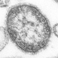 El virus del sarampión le cuesta 100.000 euros a un antivacunas y negacionista del sida