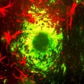 Fármaco experimental contra el cáncer restaura la memoria en ratones con Alzheimer (ING)