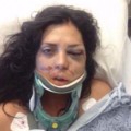 Policía de California rompe la cara contra el suelo a una modelo detenida [ENG]