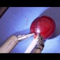 La increíble delicadeza de un robot cirujano al coser la piel de una uva