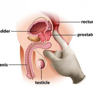 Como ordeñar la próstata (ENG)