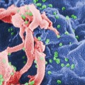 Capturan el VIH extendiéndose por el cuerpo en tiempo real por primera vez