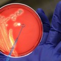 Detectan un gen que deja sin efecto al último antibiótico sin resistencia