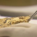 Científicos descubren en cerebros de pacientes de Alzheimer que estaban infectados por hongos de su propia flora