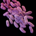 Superbacteria conocida como "la amenaza fantasma" surge en EE.UU.: más del 50% de los infectados están muriendo. (eng)