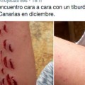 Canarias. Una mujer de 38 años sufre la mordida de un tiburón cuando nadaba