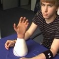 ¿Es ético amputar un brazo a un paciente para implantarle uno biónico?