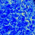 Investigadores del cáncer aseguran haber obtenido "resultados extraordinarios" usando terapia de células T (ENG)