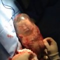 El vídeo de un bebé que nace dentro de la bolsa y se mueve sin saber que ha nacido