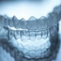 Un estudiante imprime un aparato dental en 3D para arreglarse la dentadura